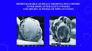 BIODEGRADABLE (SURFACE ERODING) POLY-ORTHO-
ESTER RODS AFTER (LEFT) 9 WEEKS
AND (RIGHT) 16 WEEKS OF IMPLANTATION
Drug delivery from
(a) bulk-eroding and
(b) surface-eroding
biodegradable systems.
3/29/2017 42
 