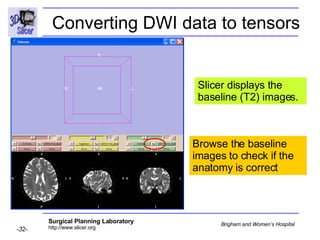 Diffusion Tensor Imaging Analysis-3749 | PPT