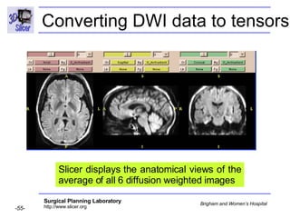 Diffusion Tensor Imaging Analysis-3749 | PPT | Digital Audio | Computer ...