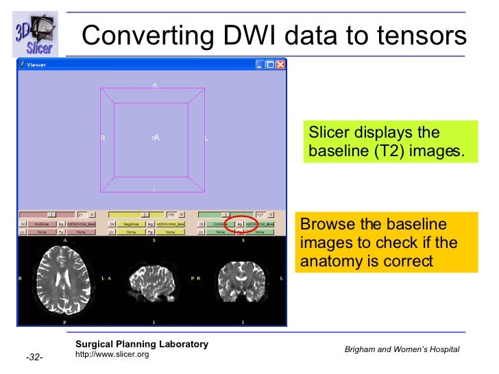 Diffusion Tensor Imaging Analysis-3749