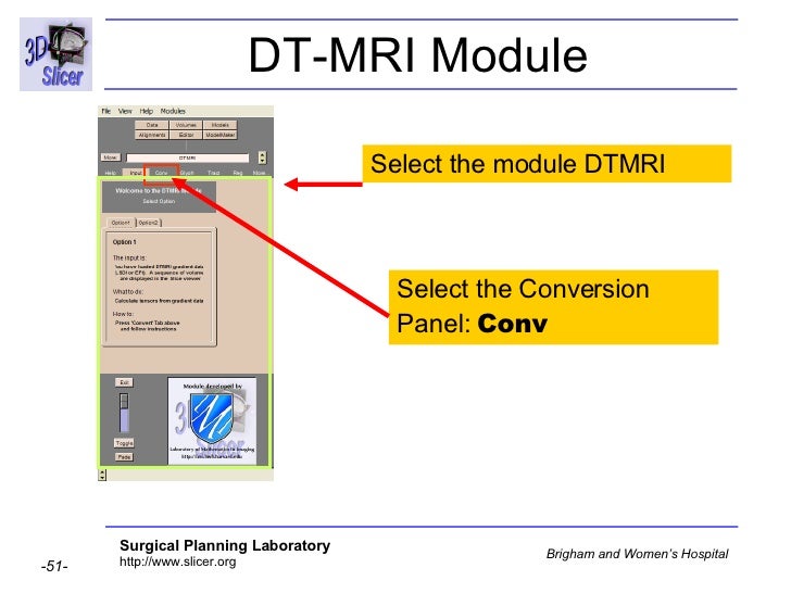 Diffusion Tensor Imaging Analysis-3749