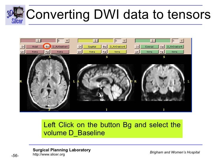 Diffusion Tensor Imaging Analysis-3749