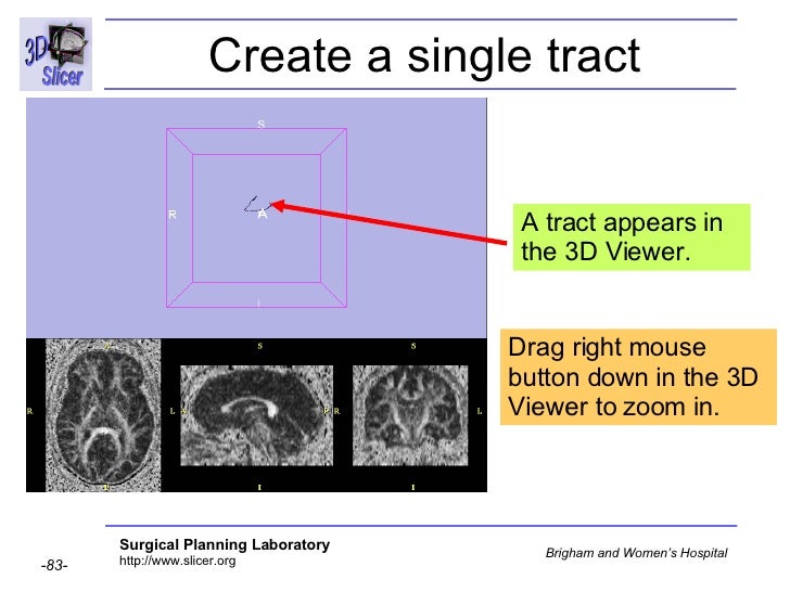 Diffusion Tensor Imaging Analysis-3749