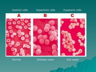 Normal Distilled water Salt water Isotonic cells Hypotonic cells Hypertonic cells 