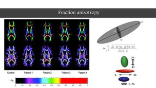Fraction anisotropy
 