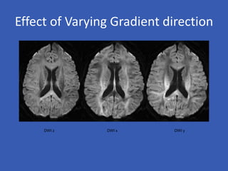 Effect of Varying Gradient direction
DWI z DWI x DWI y
 