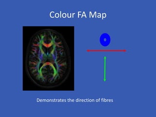 Colour FA Map
Demonstrates the direction of fibres
 