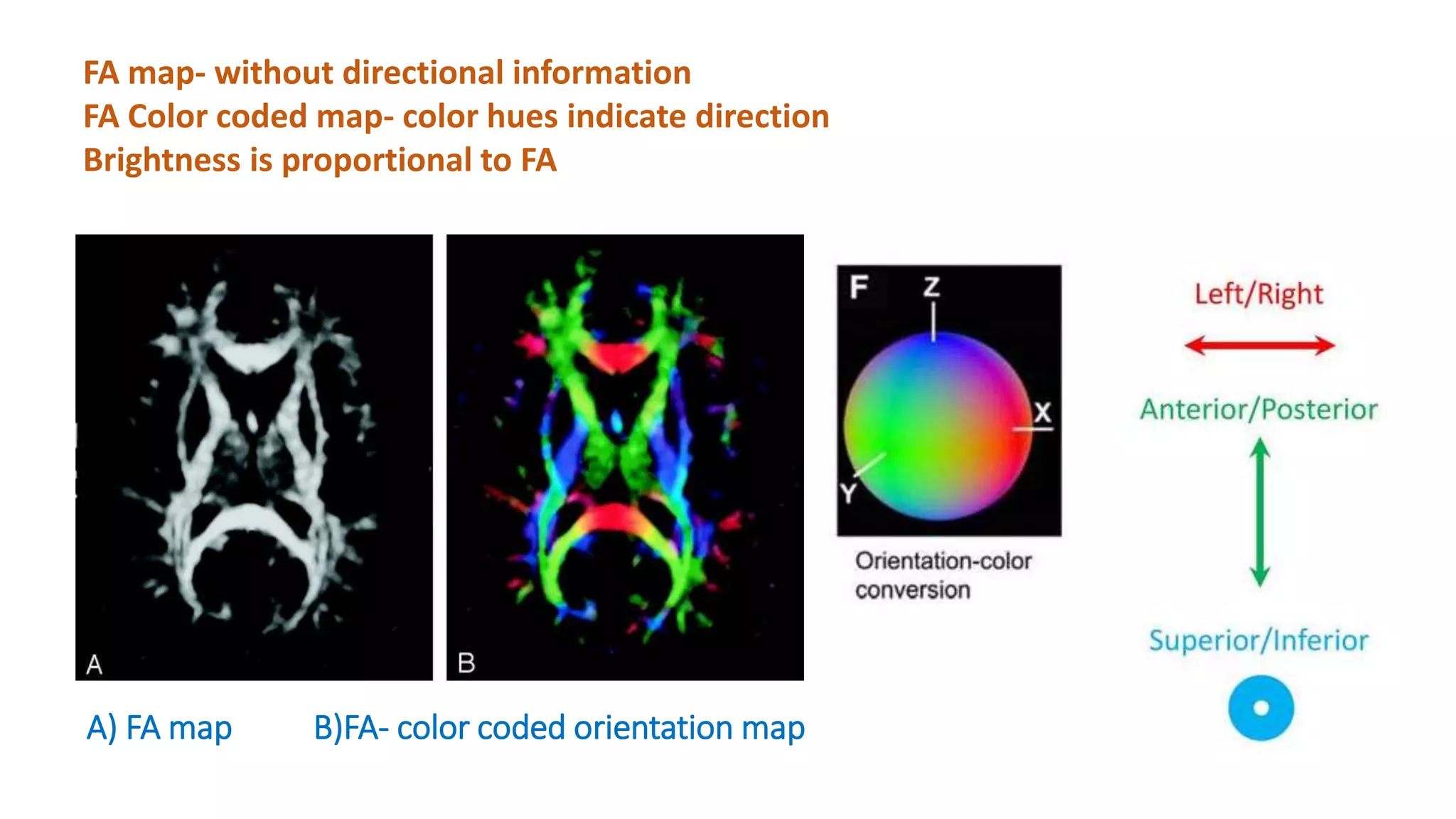 A) FA map B)FA- color coded orientation map
FA map- without directional information
FA Color coded map- color hues indicate direction
Brightness is proportional to FA
 