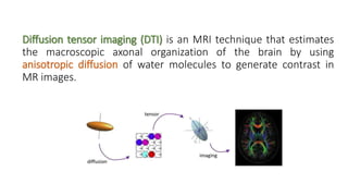 Diffusion tensor imaging .pptx