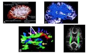 Diffusion tensor imaging .pptx