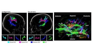 Diffusion tensor imaging .pptx