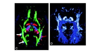 Diffusion tensor imaging .pptx