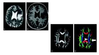 Diffusion tensor imaging .pptx