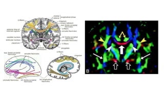Diffusion tensor imaging .pptx