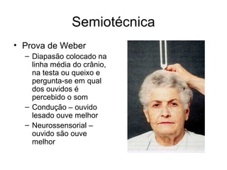 Semiotécnica 
• Prova de Weber 
– Diapasão colocado na 
linha média do crânio, 
na testa ou queixo e 
pergunta-se em qual 
dos ouvidos é 
percebido o som 
– Condução – ouvido 
lesado ouve melhor 
– Neurossensorial – 
ouvido são ouve 
melhor 
 
