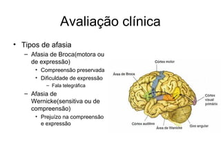 Avaliação clínica 
• Tipos de afasia 
– Afasia de Broca(motora ou 
de expressão) 
• Compreensão preservada 
• Dificuldade de expressão 
– Fala telegráfica 
– Afasia de 
Wernicke(sensitiva ou de 
compreensão) 
• Prejuízo na compreensão 
e expressão 
 