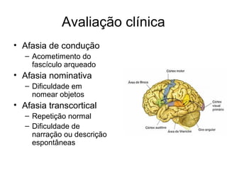 Avaliação clínica 
• Afasia de condução 
– Acometimento do 
fascículo arqueado 
• Afasia nominativa 
– Dificuldade em 
nomear objetos 
• Afasia transcortical 
– Repetição normal 
– Dificuldade de 
narração ou descrição 
espontâneas 
 