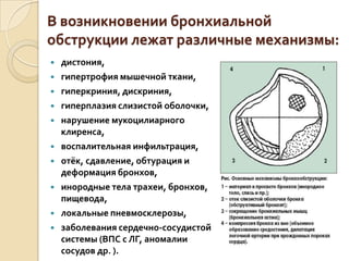 В возникновении бронхиальной
обструкции лежат различные механизмы:
 дистония,
 гипертрофия мышечной ткани,
 гиперкриния, дискриния,
 гиперплазия слизистой оболочки,
 нарушение мукоцилиарного
клиренса,
 воспалительная инфильтрация,
 отёк, сдавление, обтурация и
деформация бронхов,
 инородные тела трахеи, бронхов,
пищевода,
 локальные пневмосклерозы,
 заболевания сердечно-сосудистой
системы (ВПС с ЛГ, аномалии
сосудов др. ).
 