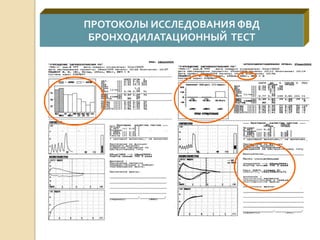 ПРОТОКОЛЫ ИССЛЕДОВАНИЯ ФВД
БРОНХОДИЛАТАЦИОННЫЙ ТЕСТ
 