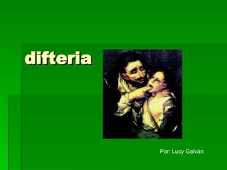 difteria Por: Lucy Galván 