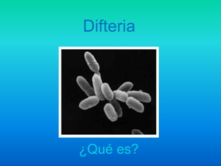Difteria
¿Qué es?
 