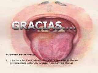 REFERENCIA BIBLIOGRAFICA:
1. E. STEPHEN BUESCHER, NELSON, TRATADO DE PEDIATRIA,19 EDICION
ENFERMEDADES INFECCIOSAS;CAPITULO 180 DIFTERIA,PÁG.969
 