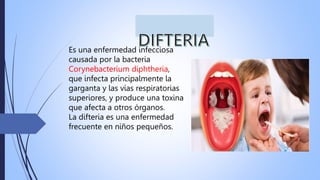 Es una enfermedad infecciosa
causada por la bacteria
Corynebacterium diphtheria,
que infecta principalmente la
garganta y las vías respiratorias
superiores, y produce una toxina
que afecta a otros órganos.
La difteria es una enfermedad
frecuente en niños pequeños.
 