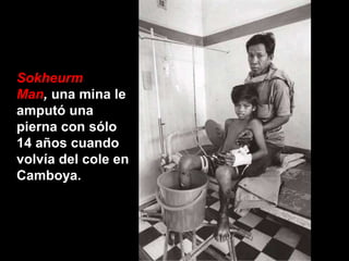 Sokheurm
Man, una mina le
amputó una
pierna con sólo
14 años cuando
volvía del cole en
Camboya.
 