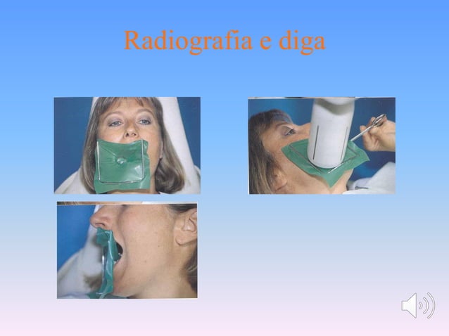 Diga In Gomma ValdentUSA 6x6 Verde - 36 Fogli Per Uso Odontoiatrico (spedizione Veloce)