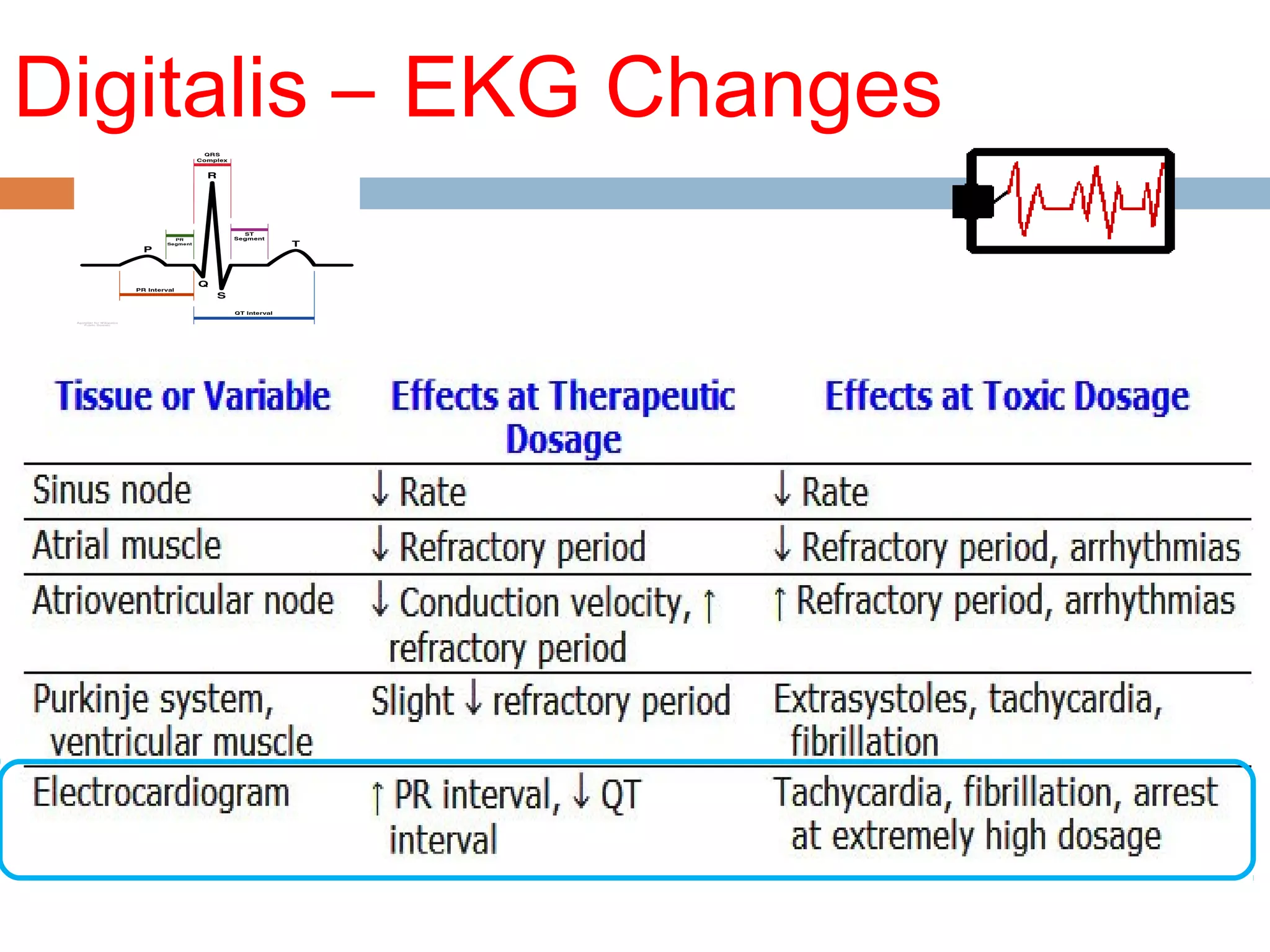 Digitalis – EKG Changes
 
