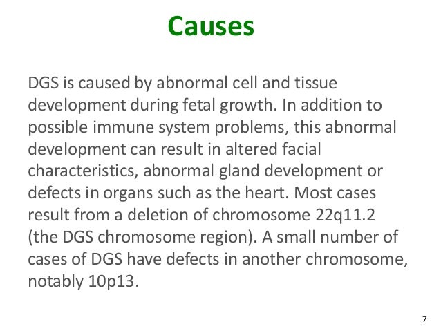 digeorge syndrome