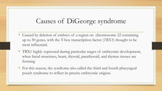 Digeorge syndrome