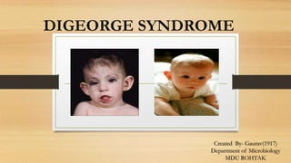 DIGEORGE SYNDROME
Created By- Gaurav(1917)
Department of Microbiology
MDU ROHTAK
 