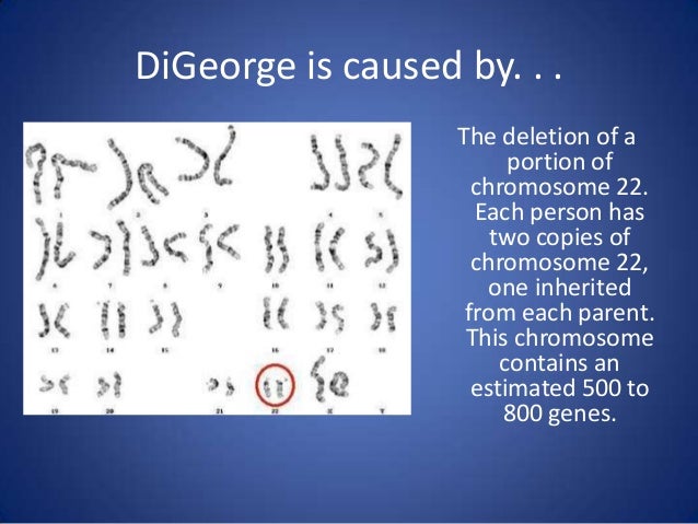 Di george syndrome (dgs)
