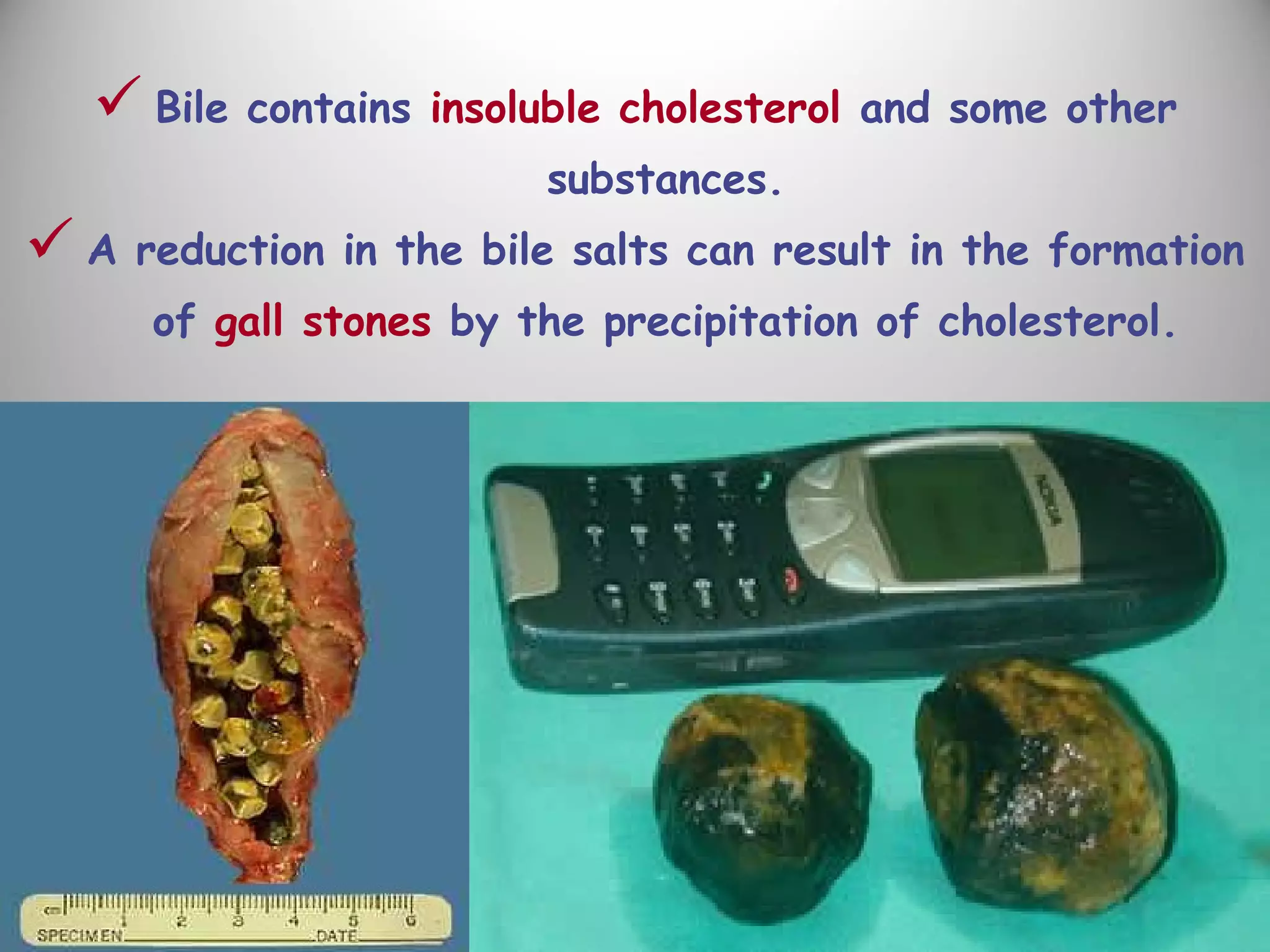  Bile contains insoluble cholesterol and some other
substances.
 A reduction in the bile salts can result in the formation
of gall stones by the precipitation of cholesterol.
 