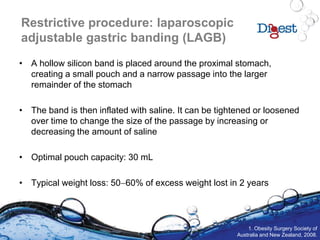 Restrictive procedure: laparoscopic
adjustable gastric banding (LAGB)
• A hollow silicon band is placed around the proximal stomach,
creating a small pouch and a narrow passage into the larger
remainder of the stomach
• The band is then inflated with saline. It can be tightened or loosened
over time to change the size of the passage by increasing or
decreasing the amount of saline
• Optimal pouch capacity: 30 mL
• Typical weight loss: 5060% of excess weight lost in 2 years
1. Obesity Surgery Society of
Australia and New Zealand, 2008.
 