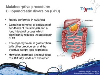 Malabsorptive procedure:
Biliopancreatic diversion (BPD)
• Rarely performed in Australia
• Combines removal or exclusion of
two-thirds of the stomach and a
long intestinal bypass which
significantly reduces the absorption
of fat
• The capacity to eat is greater than
with other procedures, and the
eventual weight loss is greatest
• However, diarrhoea and foul flatus
result if fatty foods are overeaten
1. Obesity Surgery Society of
Australia and New Zealand, 2008.
 