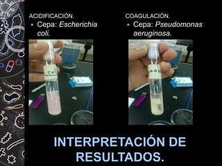 INTERPRETACIÓN DE
RESULTADOS.
ACIDIFICACIÓN. COAGULACIÓN.
 Cepa: Escherichia
coli.
 Cepa: Pseudomonas
aeruginosa.
 