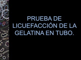 PRUEBA DE
LICUEFACCIÓN DE LA
GELATINA EN TUBO.
 