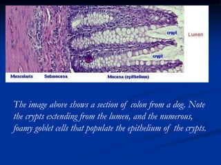 The image above shows a section of colon from a dog. Note
the crypts extending from the lumen, and the numerous,
foamy goblet cells that populate the epithelium of the crypts.
 