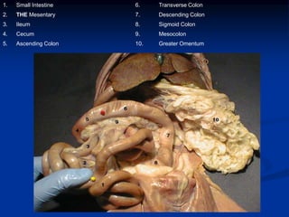 1. Small Intestine 6. Transverse Colon
2. THE Mesentary 7. Descending Colon
3. Ileum 8. Sigmoid Colon
4. Cecum 9. Mesocolon
5. Ascending Colon 10. Greater Omentum
 