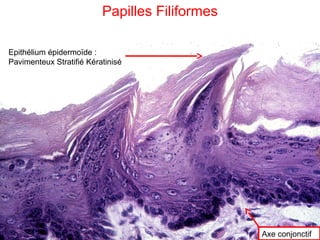 Papilles Filiformes

Epithélium épidermoïde :
Pavimenteux Stratifié Kératinisé




                                                Axe conjonctif
 