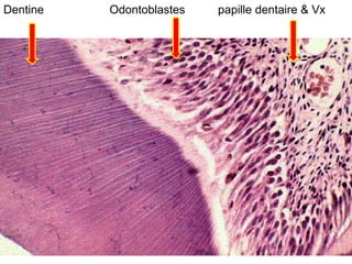 Dentine   Odontoblastes   papille dentaire & Vx
 