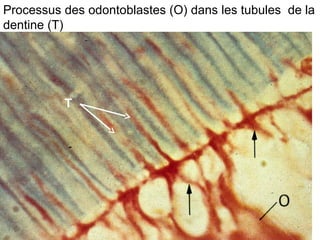 Processus des odontoblastes (O) dans les tubules de la
dentine (T)




          T
 