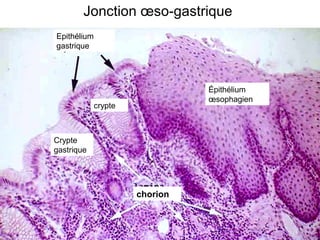 Jonction œso-gastrique
Epithélium
gastrique




                                Épithélium
                                œsophagien
             crypte



Crypte
gastrique




                      chorion
 