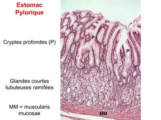 Estomac
    Pylorique



Cryptes profondes (P)




  Glandes courtes
tubuleuses ramifées


  MM = muscularis
    mucosae
 