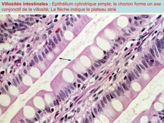 Villosités intestinales : Epithélium cylindrique simple; le chorion forme un axe
conjonctif de la villosité; La flèche indique le plateau strié
 