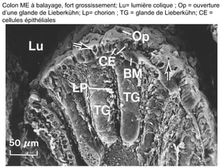 Colon ME à balayage, fort grossissement; Lu= lumière colique ; Op = ouverture
d’une glande de Lieberkühn; Lp= chorion ; TG = glande de Lieberkühn; CE =
cellules épithéliales
 
