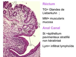 Réctum
TG= Glandes de
Lieberkuhn ;
MM= muscularis
mucosa

Anal Canal
St =épithélium
pavimenteux stratifié
non kératinisé
Lym= infiltrat lymphoïde
 