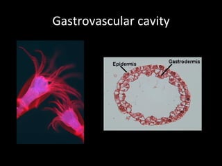 Gastrovascular cavity 